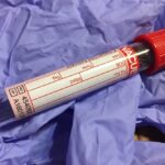 Próbka laboratoryjna krwi